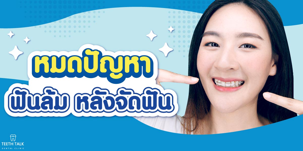 รีเทนเนอร์