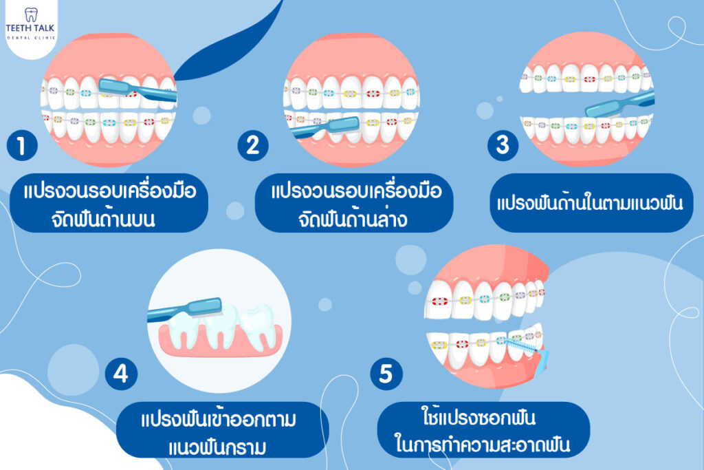 แปรงฟัน