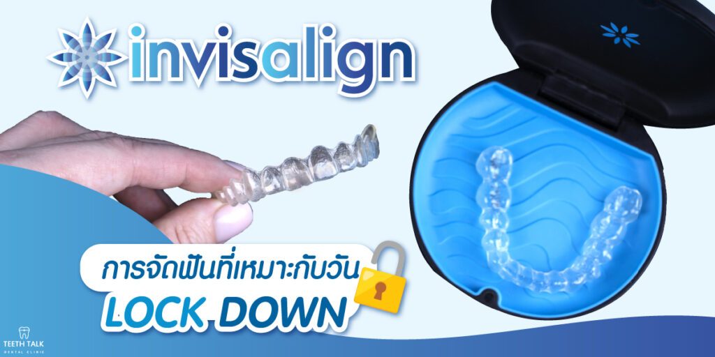 จัดฟัน invisalign