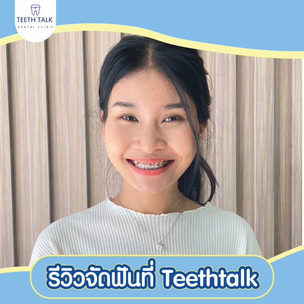 จัดฟันแบบใส Invisalign VS จัดฟันเหล็ก แบบไหนดีกว่ากัน