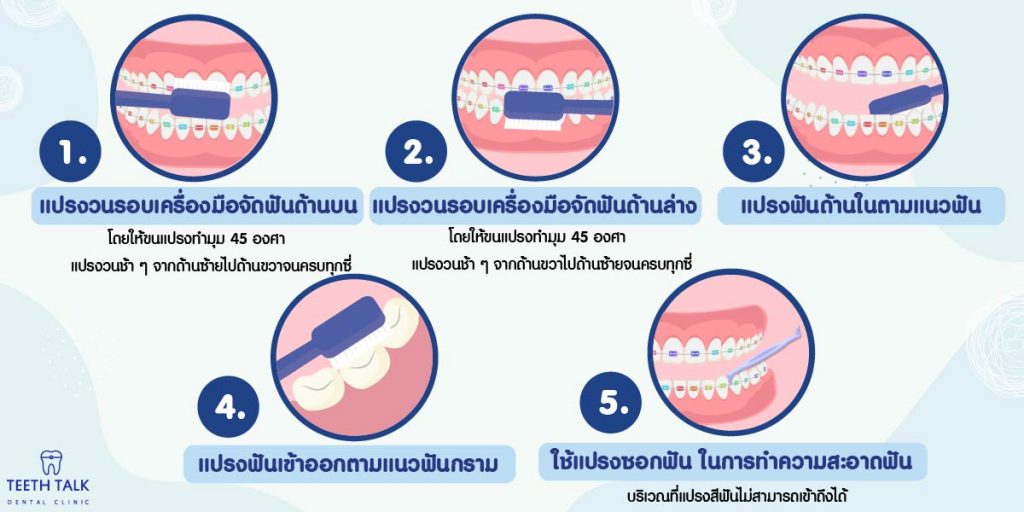 จัดฟันกินอะไรได้บ้าง??? - Teeth Talk Dental Clinic