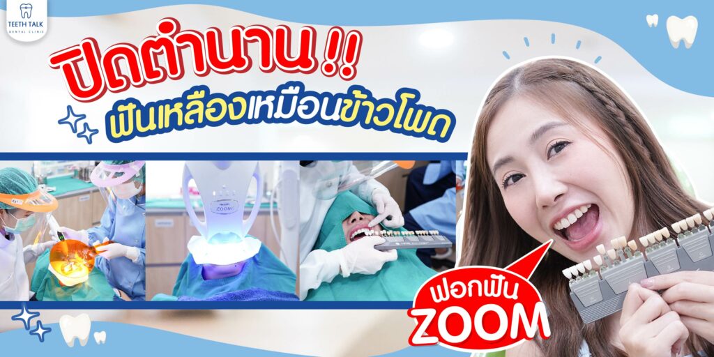 รีวิวฟอกสีฟัน ZOOM ครั้งแรก ปิดตำนานฟันเหลืองเหมือนข้าวโพด