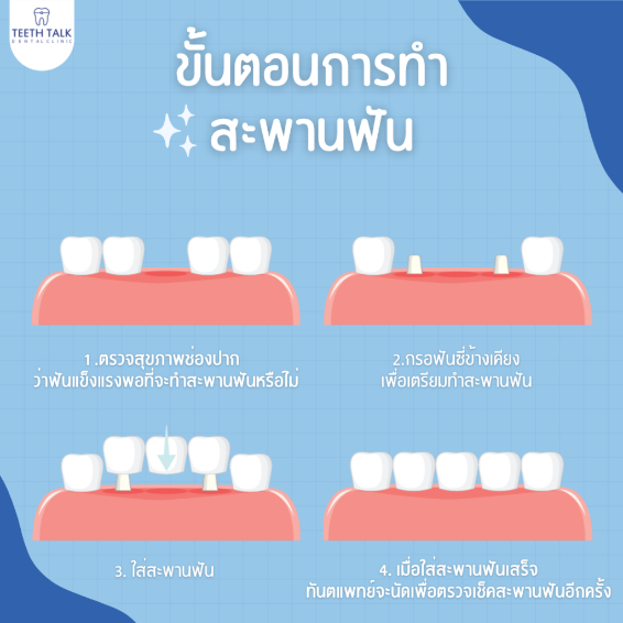 เช็กลิสต์ ศูนย์ทันตกรรม Teeth Talk ที่ไม่ควรพลาด ! มีบริการอะไรบ้าง ?