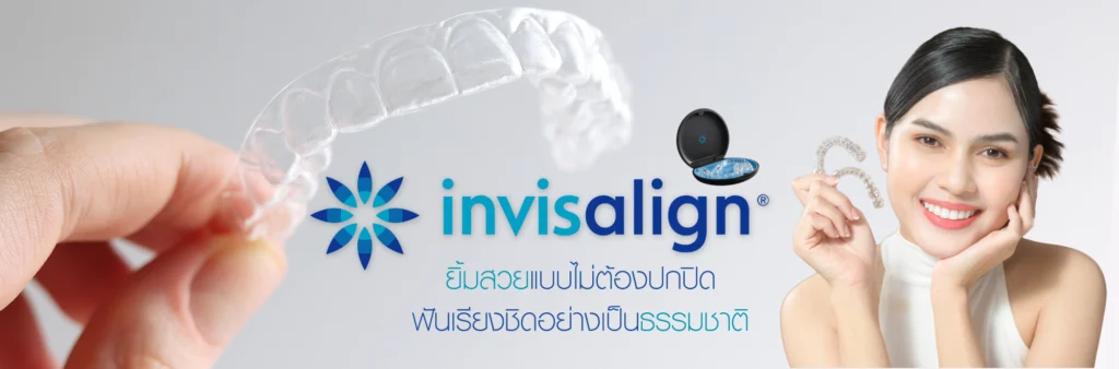 จัดฟันใส Invisalign แนะนำที่ไหนดี?