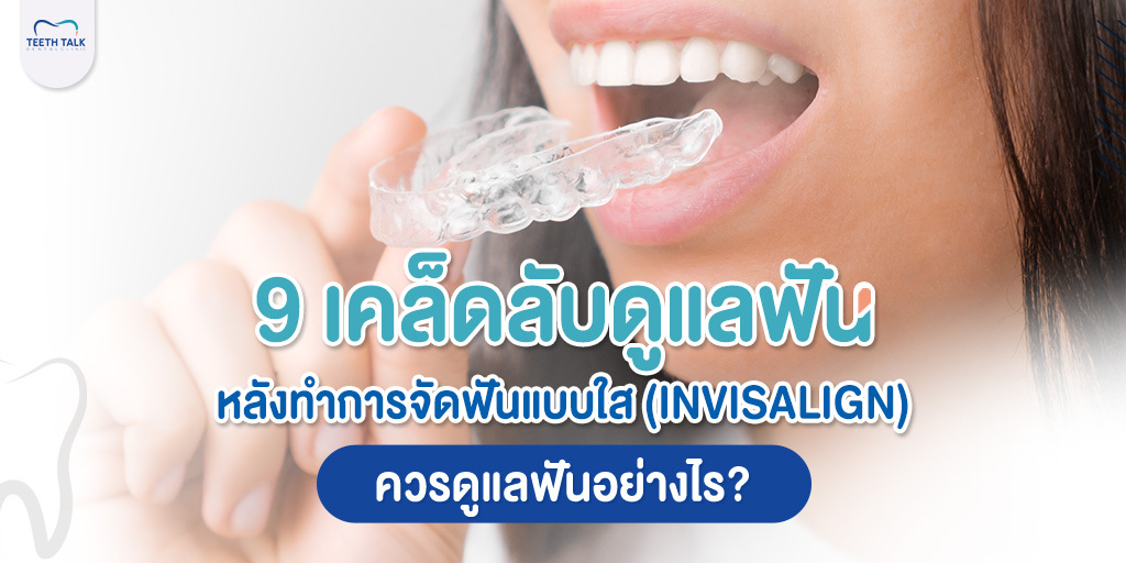 9 เคล็ดลับดูแลฟัน หลังทำ การจัดฟันแบบใส (Invisalign)  ควรดูแลฟันอย่างไร?