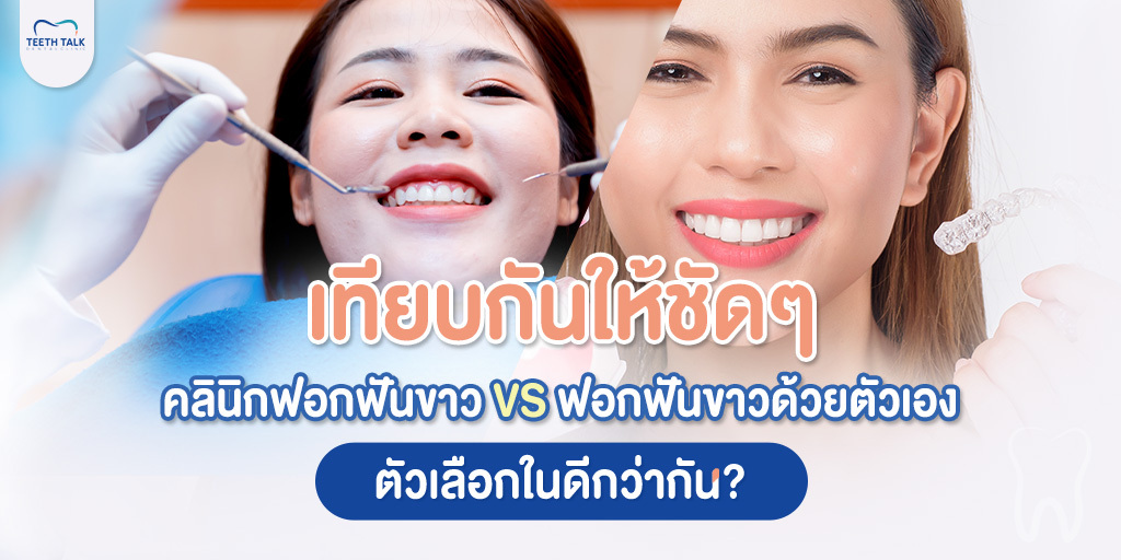 เทียบกันให้ชัดๆ คลินิกฟอกฟันขาว VS ฟอกฟันขาวด้วยตัวเอง ตัวเลือกในดีกว่ากัน?