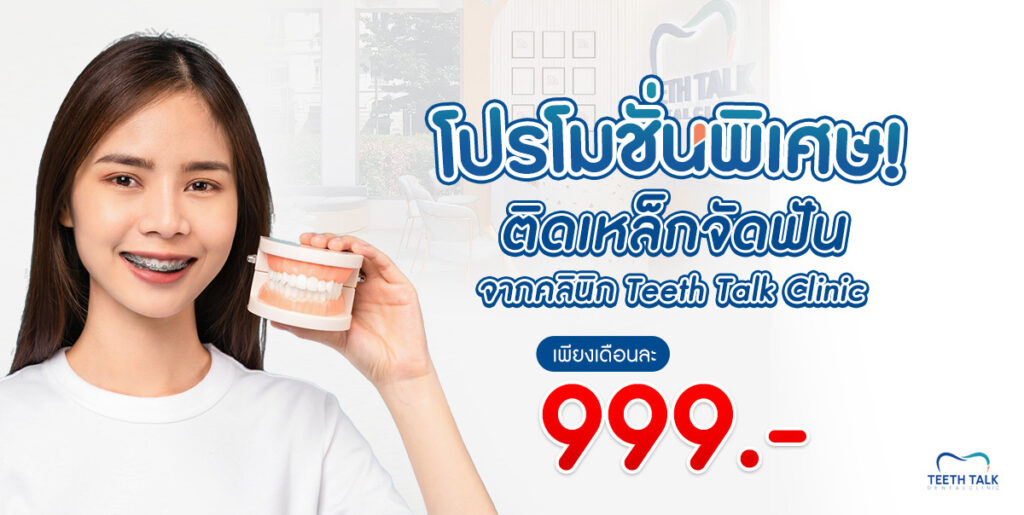 โปรโมชั่นพิเศษ! ติดเหล็กจัดฟัน จากคลินิก Teeth Talk Clinic เพียงเดือนละ 999.-